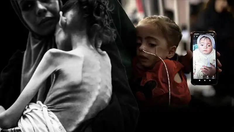 Küçük Meryem'in Açlıkla Mücadelesi: 25 Kilodan 10 Kiloya Düşen Bir Hayat
