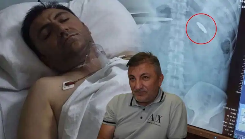 15 Temmuz’un Unutulmaz İzleri: Kurşun Yaralıları ve Hayatta Kalma Mücadelesi