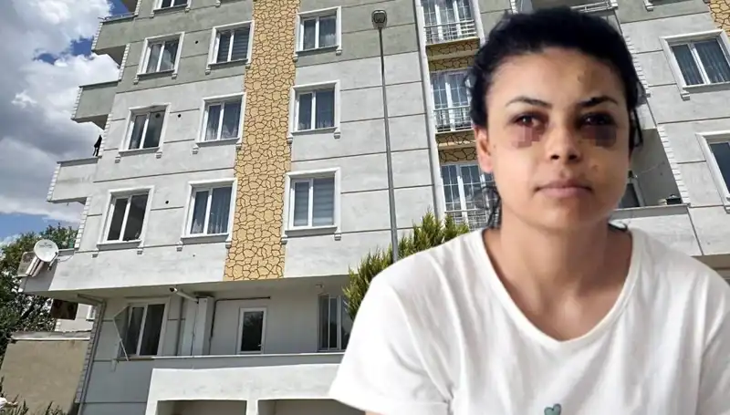 Düğündeki Maganda Dehşeti: Saçmalar Gelinin Gözünü Yaraladı!